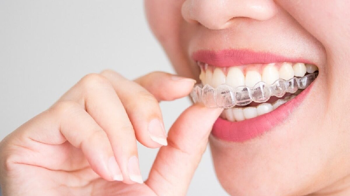 21 Braces Tips Recommended by Dentists for Adults Over 50 Years Old