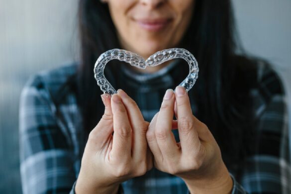 Clear Aligners-Your Questions Answered