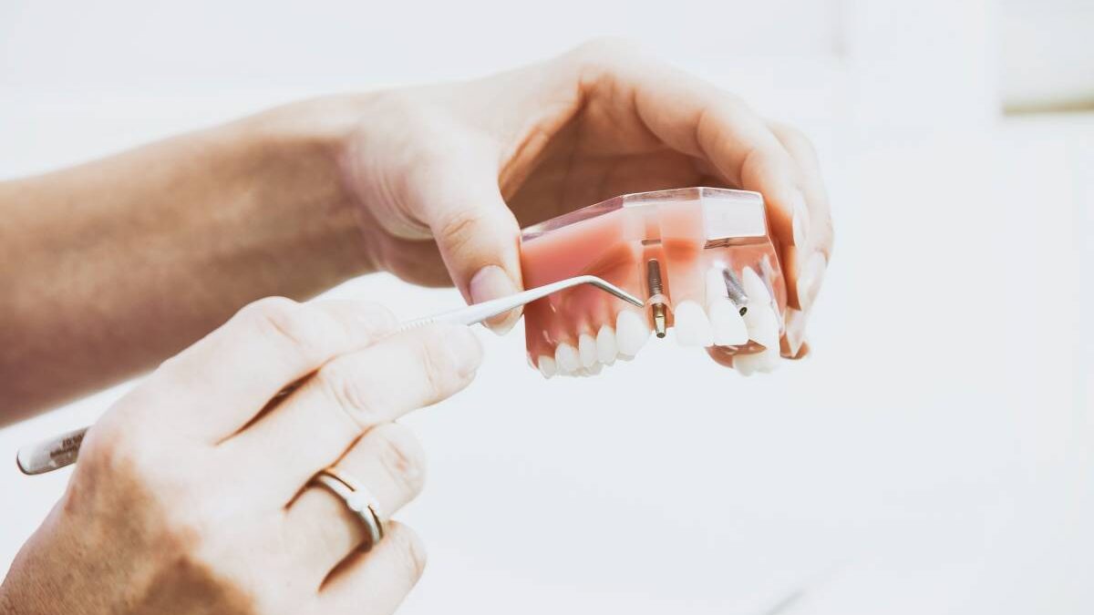 A Timeline of How Dental Implant Healing Goes
