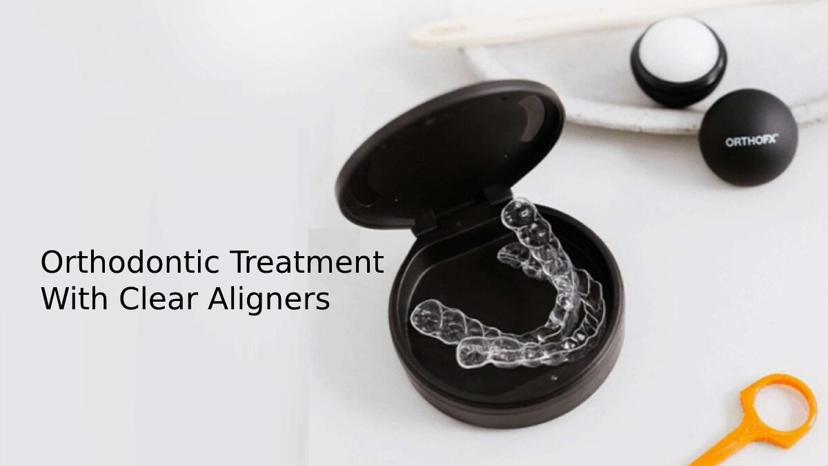 Orthodontic Treatment With Clear Aligners