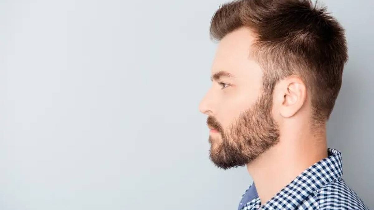 Should You Get a Hair Transplant?