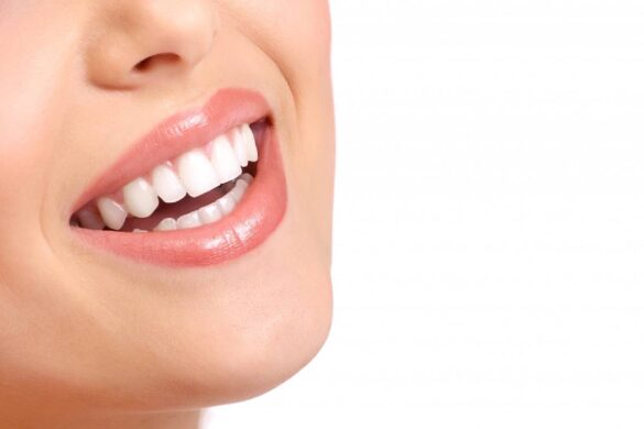 What Are the Different Types of Gum Disease